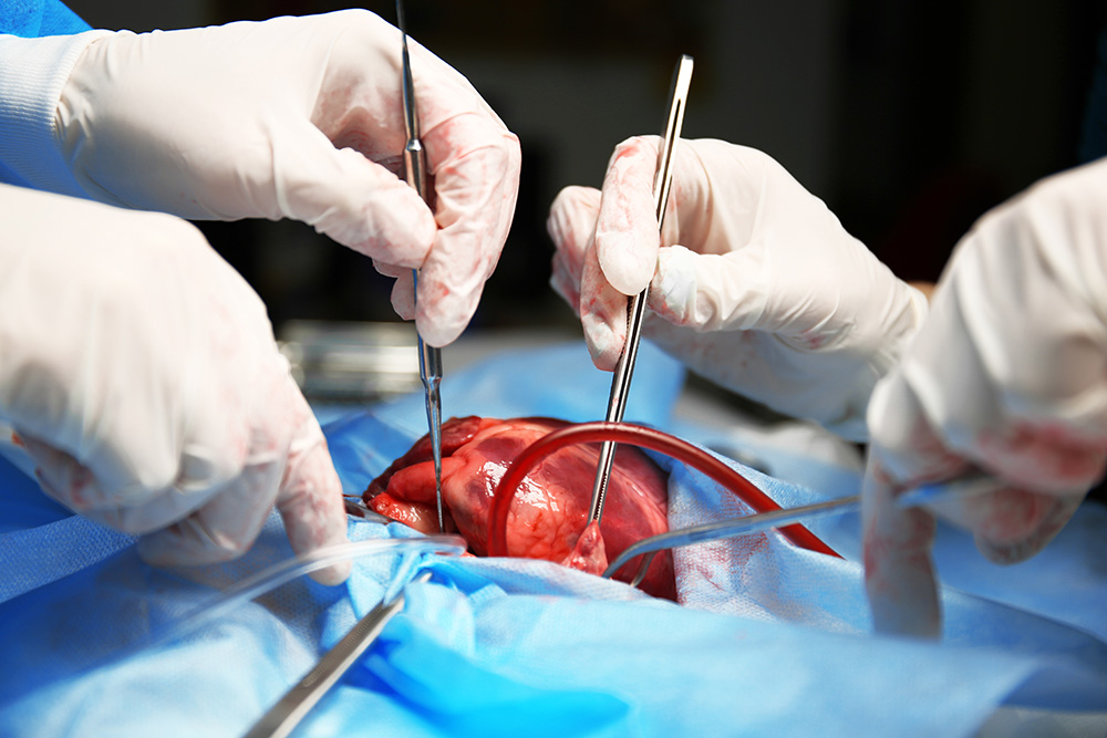 Surgeons perform surgery on heart failure patient.